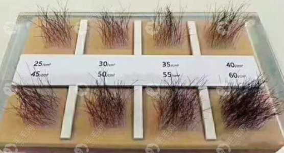 植发多少钱一根?植发多少钱一根?? 第4张 植发多少钱一根?植发多少钱一根?? 第4张